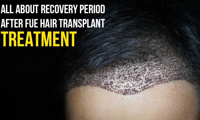 Best Hair Transplant Clinic in Delhi