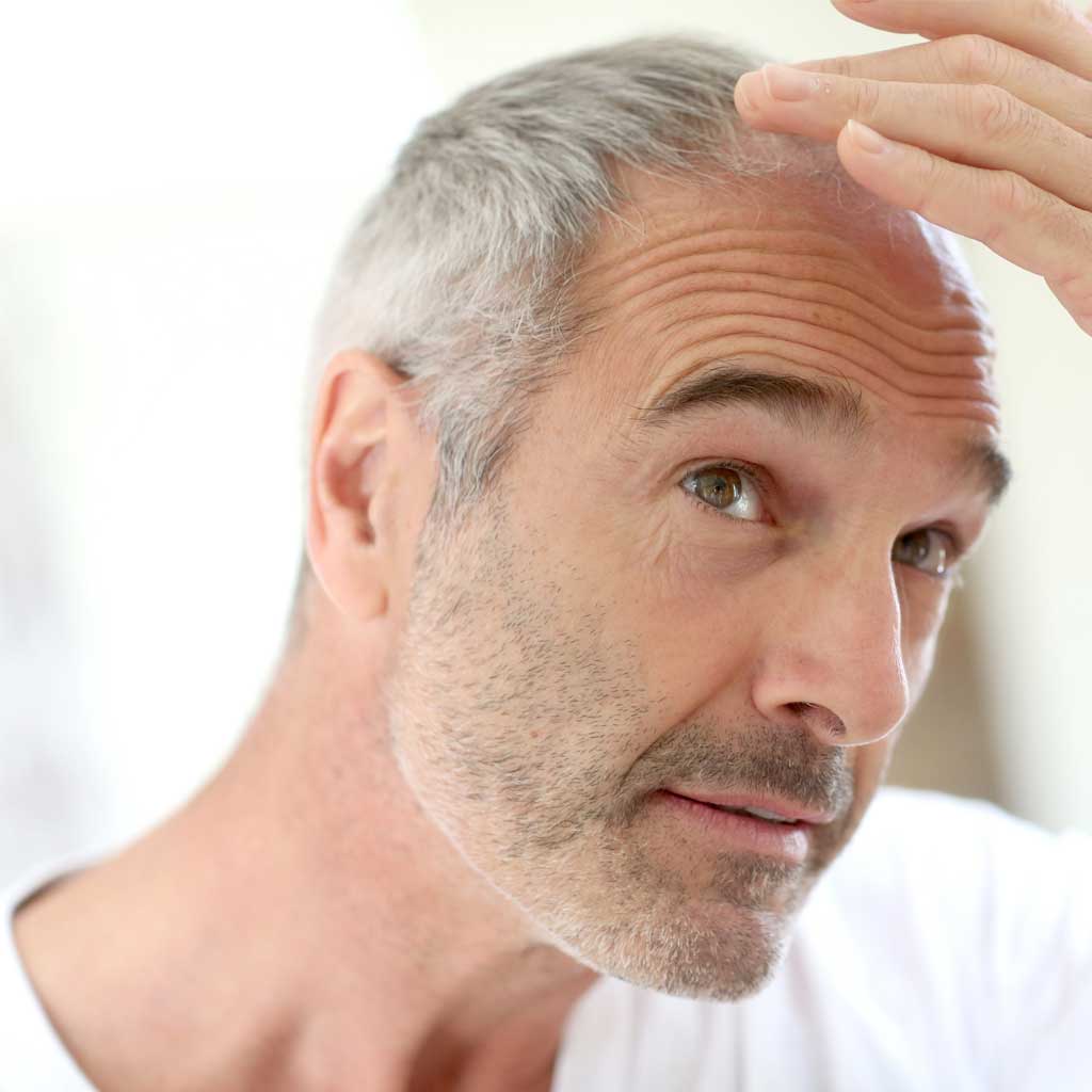 how to tackle hair loss?