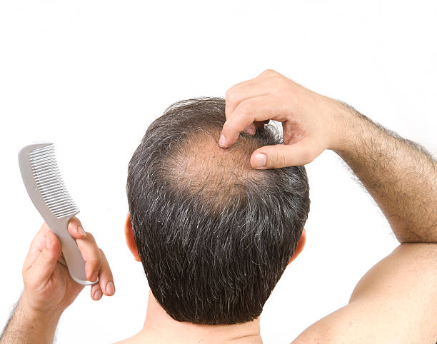 hair regrowth on bald spot