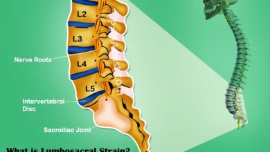 What-are-the-long-term-side-effects-of-a-Lumbosacral-Strain
