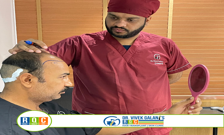 RQC Hair Transplant in Surat