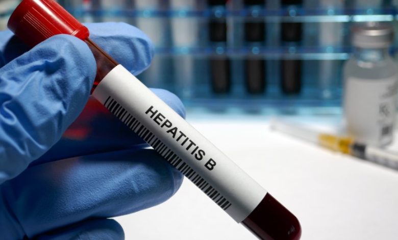 Hepatitis B Test