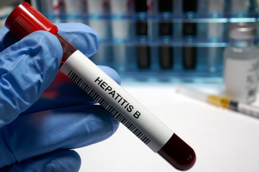 Hepatitis B Test